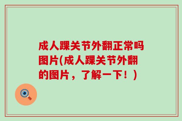 成人踝关节外翻正常吗图片(成人踝关节外翻的图片，了解一下！)