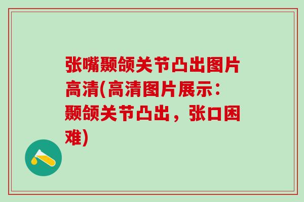 张嘴颞颌关节凸出图片高清(高清图片展示：颞颌关节凸出，张口困难)
