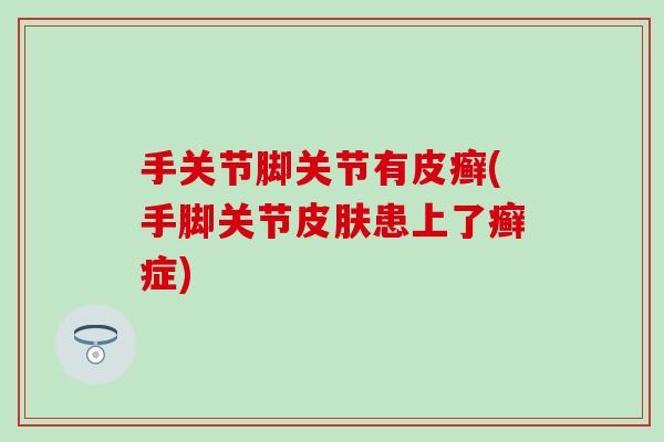 手关节脚关节有皮癣(手脚关节皮肤患上了癣症)