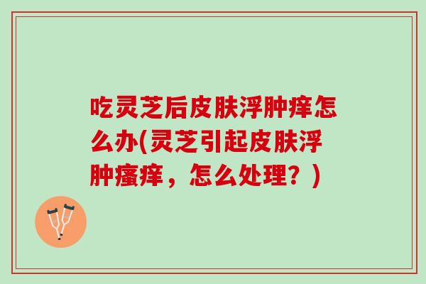 吃灵芝后浮肿痒怎么办(灵芝引起浮肿,怎么处理?) 吃灵芝后浮肿痒怎么办(灵芝引起浮肿,怎么处理?)