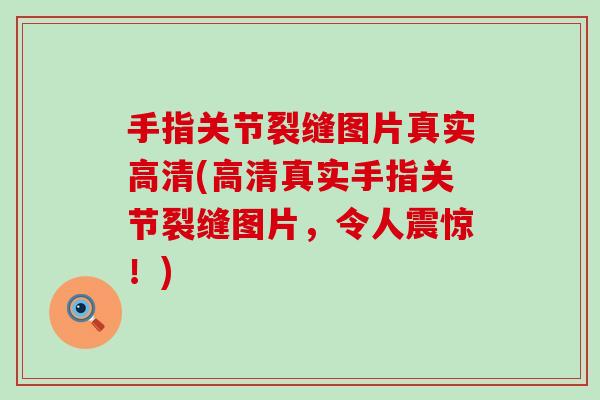 手指关节裂缝图片真实高清(高清真实手指关节裂缝图片，令人震惊！)