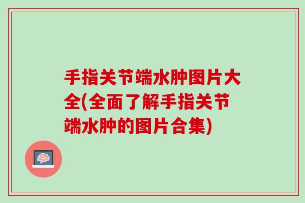 手指关节端水肿图片大全(全面了解手指关节端水肿的图片合集)