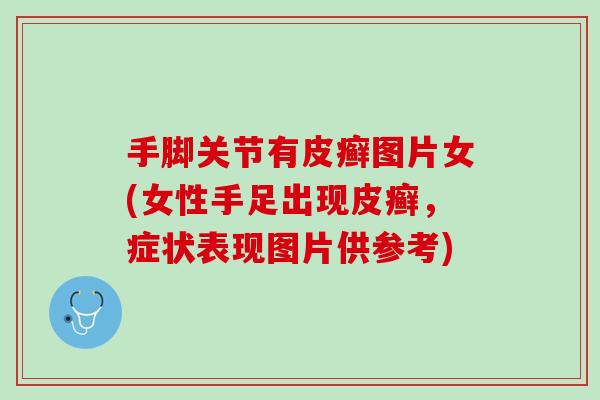 手脚关节有皮癣图片女(女性手足出现皮癣，症状表现图片供参考)