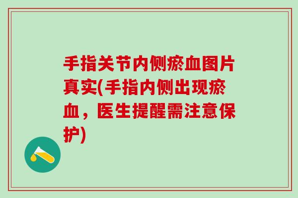 手指关节内侧瘀血图片真实(手指内侧出现瘀血，医生提醒需注意保护)