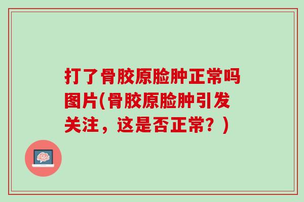 打了骨胶原脸肿正常吗图片(骨胶原脸肿引发关注，这是否正常？)
