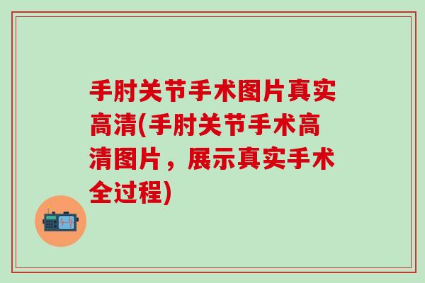 手肘关节手术图片真实高清(手肘关节手术高清图片，展示真实手术全过程)