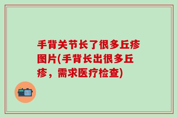 手背关节长了很多丘疹图片(手背长出很多丘疹，需求医疗检查)