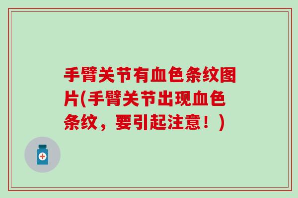 手臂关节有血色条纹图片(手臂关节出现血色条纹，要引起注意！)