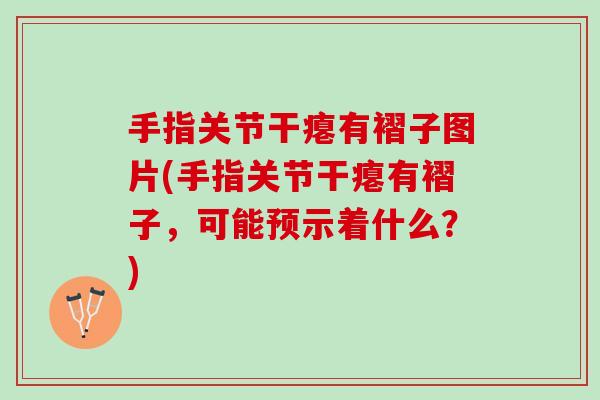 手指关节干瘪有褶子图片(手指关节干瘪有褶子，可能预示着什么？)