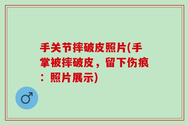 手关节摔破皮照片(手掌被摔破皮，留下伤痕：照片展示)