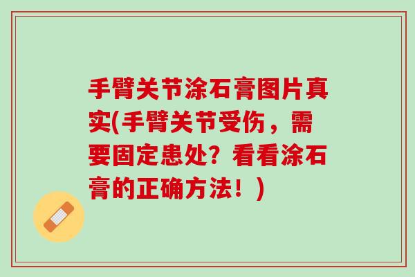 手臂关节涂石膏图片真实(手臂关节受伤，需要固定患处？看看涂石膏的正确方法！)