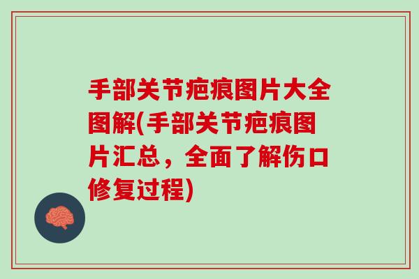 手部关节疤痕图片大全图解(手部关节疤痕图片汇总，全面了解伤口修复过程)