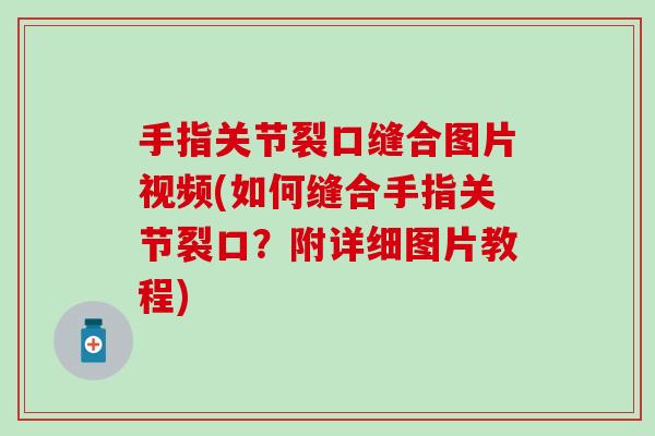 手指关节裂口缝合图片视频(如何缝合手指关节裂口？附详细图片教程)