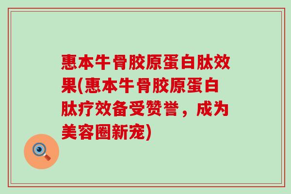 惠本牛骨胶原蛋白肽效果(惠本牛骨胶原蛋白肽疗效备受赞誉，成为美容圈新宠)