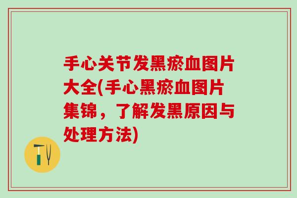 手心关节发黑瘀血图片大全(手心黑瘀血图片集锦，了解发黑原因与处理方法)