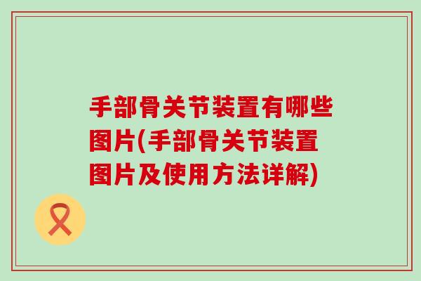 手部骨关节装置有哪些图片(手部骨关节装置图片及使用方法详解)