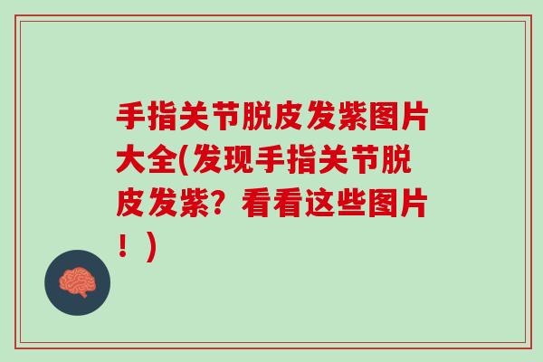 手指关节脱皮发紫图片大全(发现手指关节脱皮发紫？看看这些图片！)