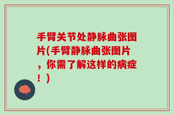 手臂关节处静脉曲张图片(手臂静脉曲张图片，你需了解这样的病症！)