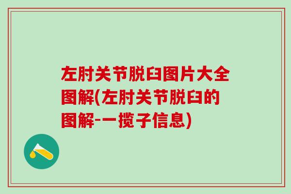 左肘关节脱臼图片大全图解(左肘关节脱臼的图解-一揽子信息)
