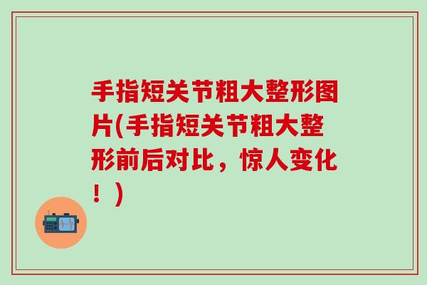 手指短关节粗大整形图片(手指短关节粗大整形前后对比，惊人变化！)