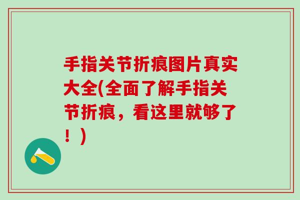 手指关节折痕图片真实大全(全面了解手指关节折痕,看这里就够了!) 手指关节折痕图片真实大全(全面了解手指关节折痕,看这里就够了!)