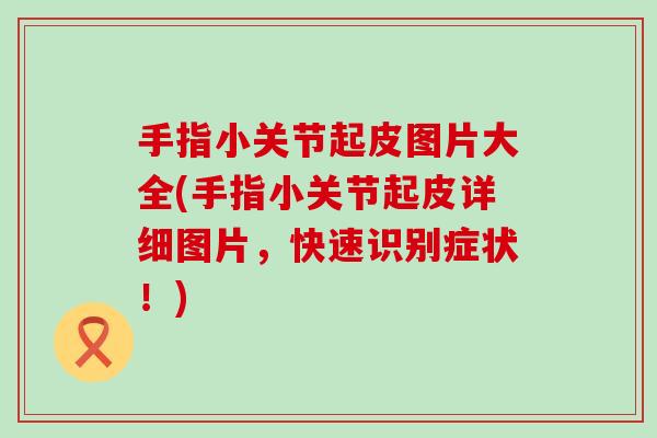 手指小关节起皮图片大全(手指小关节起皮详细图片，快速识别症状！)