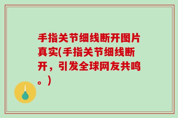 手指关节细线断开图片真实(手指关节细线断开，引发全球网友共鸣。)