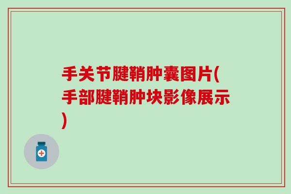 手关节腱鞘肿囊图片(手部腱鞘肿块影像展示)