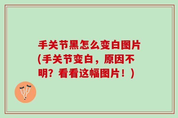 手关节黑怎么变白图片(手关节变白，原因不明？看看这幅图片！)