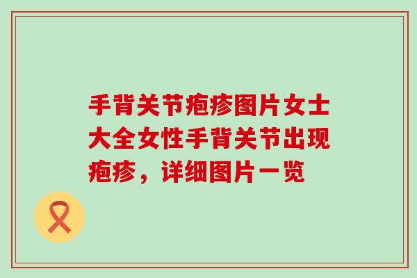 手背关节疱疹图片女士大全女性手背关节出现疱疹，详细图片一览