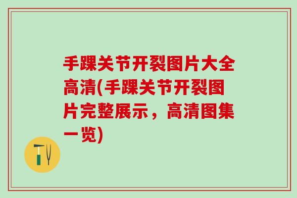 手踝关节开裂图片大全高清(手踝关节开裂图片完整展示，高清图集一览)