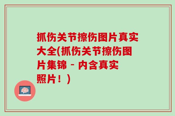 抓伤关节擦伤图片真实大全(抓伤关节擦伤图片集锦 - 内含真实照片！)