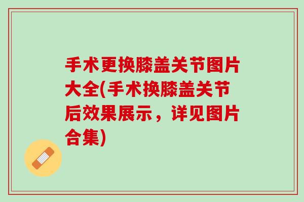 手术更换膝盖关节图片大全(手术换膝盖关节后效果展示，详见图片合集)