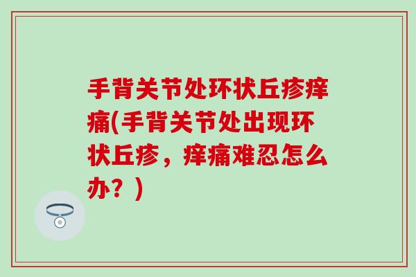 手背关节处环状丘疹痒痛(手背关节处出现环状丘疹，痒痛难忍怎么办？)