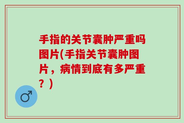 手指的关节囊肿严重吗图片(手指关节囊肿图片，病情到底有多严重？)