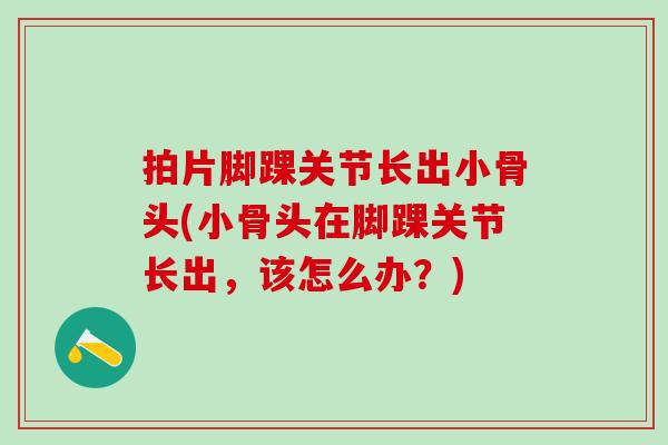 拍片脚踝关节长出小骨头(小骨头在脚踝关节长出，该怎么办？)