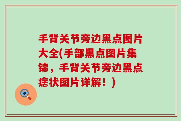 手背关节旁边黑点图片大全(手部黑点图片集锦，手背关节旁边黑点痣状图片详解！)