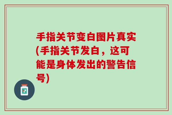 手指关节变白图片真实(手指关节发白，这可能是身体发出的警告信号)
