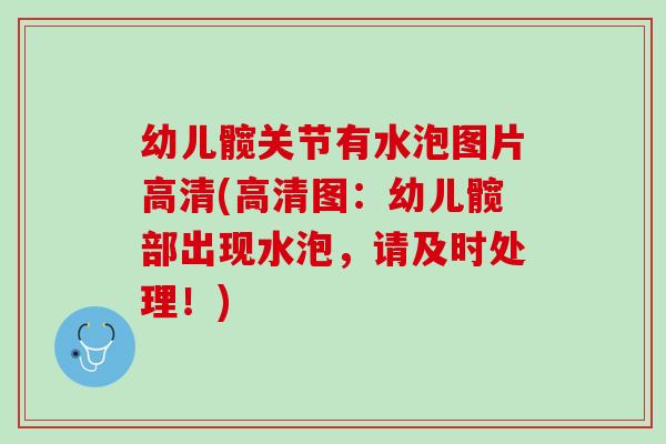 幼儿髋关节有水泡图片高清(高清图：幼儿髋部出现水泡，请及时处理！)