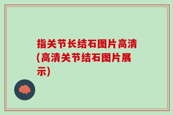 指关节长结石图片高清(高清关节结石图片展示)