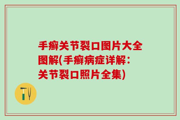 手癣关节裂口图片大全图解(手癣病症详解：关节裂口照片全集)