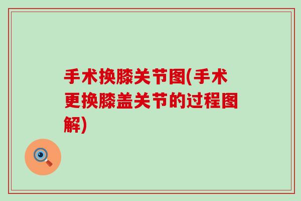 手术换膝关节图(手术更换膝盖关节的过程图解)