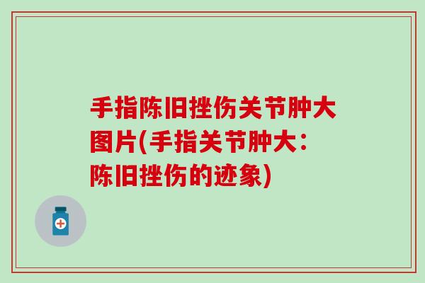 手指陈旧挫伤关节肿大图片(手指关节肿大：陈旧挫伤的迹象)