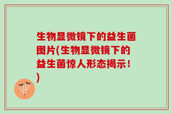 生物显微镜下的益生菌图片(生物显微镜下的益生菌惊人形态揭示!) 生物显微镜下的益生菌图片(生物显微镜下的益生菌惊人形态揭示!)