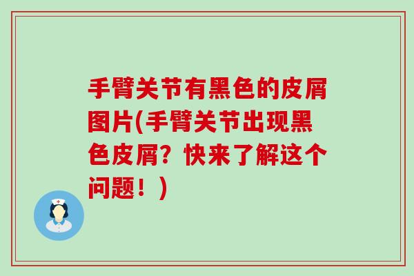 手臂关节有黑色的皮屑图片(手臂关节出现黑色皮屑？快来了解这个问题！)