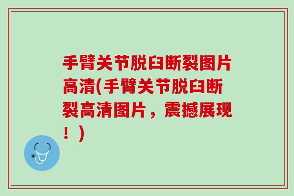 手臂关节脱臼断裂图片高清(手臂关节脱臼断裂高清图片，震撼展现！)