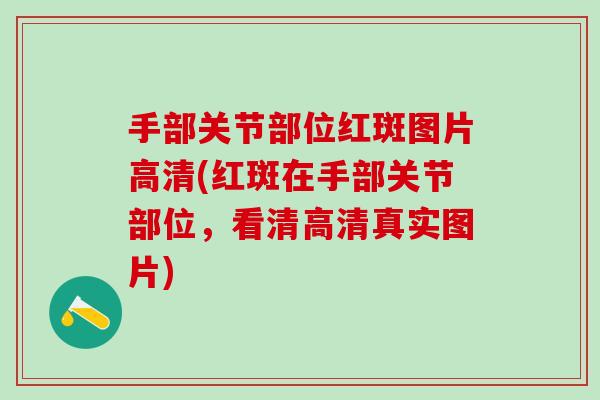 手部关节部位红斑图片高清(红斑在手部关节部位，看清高清真实图片)