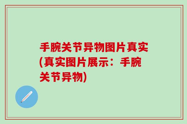 手腕关节异物图片真实(真实图片展示:手腕关节异物) 手腕关节异物图片真实(真实图片展示:手腕关节异物)