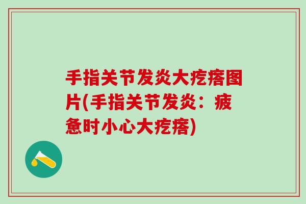 手指关节发炎大疙瘩图片(手指关节发炎：疲惫时小心大疙瘩)