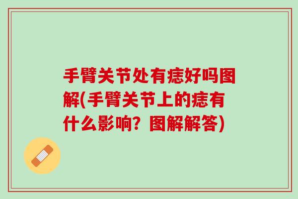 手臂关节处有痣好吗图解(手臂关节上的痣有什么影响？图解解答)